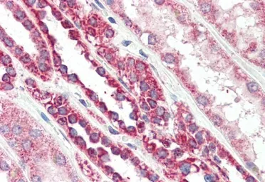 Anti-PBR antibody, C-term used in IHC (Paraffin sections) (IHC-P). GTX89258