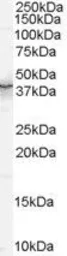 Anti-QKI antibody, N-term used in Western Blot (WB). GTX89271