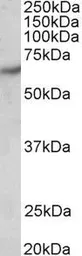 Anti-PAK1 antibody, Internal used in Western Blot (WB). GTX89274