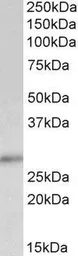 Anti-p27 Kip1 antibody, C-term used in Western Blot (WB). GTX89293