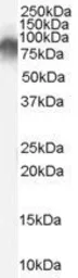 Anti-Radixin antibody, Internal used in Western Blot (WB). GTX89297