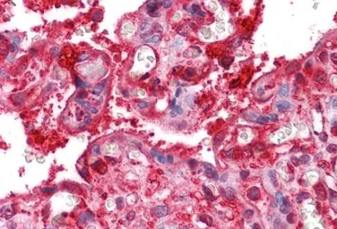 Anti-Radixin antibody, Internal used in IHC (Paraffin sections) (IHC-P). GTX89297