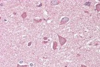 Anti-NCAM2 antibody, C-term used in IHC (Paraffin sections) (IHC-P). GTX89311