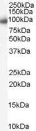 Anti-Importin beta 1 antibody, C-term used in Western Blot (WB). GTX89314