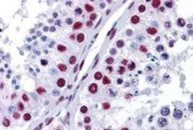 Anti-p54nrb antibody, C-term used in IHC (Paraffin sections) (IHC-P). GTX89315