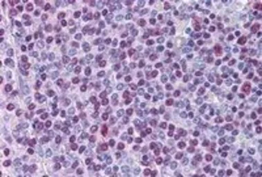 Anti-p54nrb antibody, C-term used in IHC (Paraffin sections) (IHC-P). GTX89315