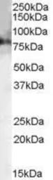Anti-Choline Acetyltransferase antibody, C-term used in Western Blot (WB). GTX89316