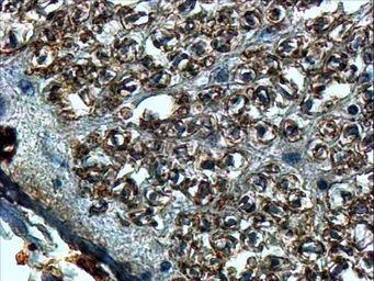 Anti-SLIT2 antibody, Internal used in IHC (Paraffin sections) (IHC-P). GTX89329