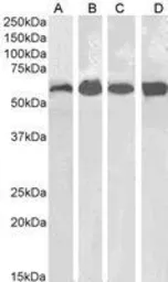 Anti-Catalase antibody, Internal used in Western Blot (WB). GTX89332