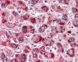 Anti-Catalase antibody, Internal used in IHC (Paraffin sections) (IHC-P). GTX89332