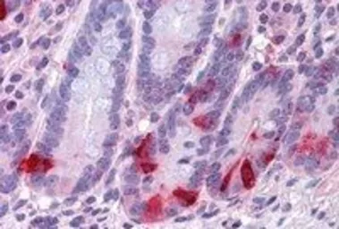 Anti-Chromogranin A precursor antibody, Internal used in IHC (Paraffin sections) (IHC-P). GTX89334