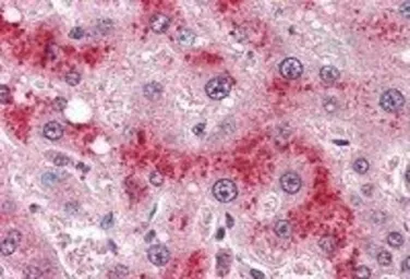 Anti-Leptin Receptor antibody, Internal used in IHC (Paraffin sections) (IHC-P). GTX89338
