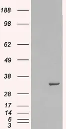 Anti-Syntaxin 6 antibody, Internal used in Western Blot (WB). GTX89342