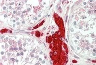 Anti-PGRMC1 antibody, C-term used in IHC (Paraffin sections) (IHC-P). GTX89362