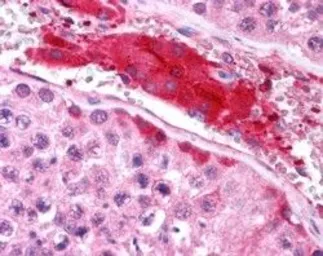Anti-HGS antibody, Internal used in IHC (Paraffin sections) (IHC-P). GTX89364