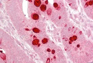 Anti-AGO1 antibody, Internal used in IHC (Paraffin sections) (IHC-P). GTX89393
