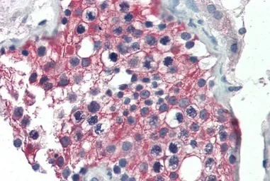 Anti-ALDH1A1 antibody, Internal used in IHC (Paraffin sections) (IHC-P). GTX89404