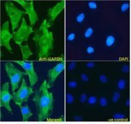 Anti-GAPDH antibody, Internal used in Immunocytochemistry/ Immunofluorescence (ICC/IF). GTX89409
