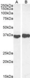 Anti-GAPDH antibody, Internal used in Western Blot (WB). GTX89409