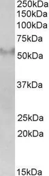 Anti-FSD1 antibody, Internal used in Western Blot (WB). GTX89413
