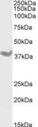 Anti-DAZL antibody, Internal used in Western Blot (WB). GTX89448