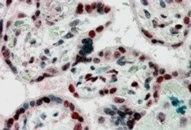 Anti-CBX1 / HP1 beta antibody, Internal used in IHC (Paraffin sections) (IHC-P). GTX89455