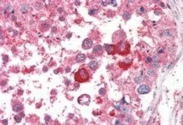 Anti-PCID1 antibody, C-term used in IHC (Paraffin sections) (IHC-P). GTX89456