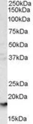 Anti-Glycophorin A antibody, C-term used in Western Blot (WB). GTX89457