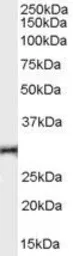Anti-TNFRSF14 antibody, Internal used in Western Blot (WB). GTX89465