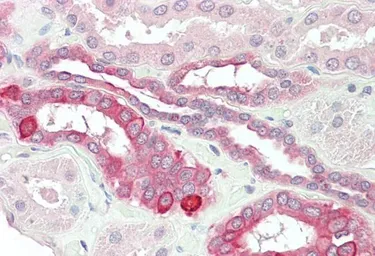 Anti-TNFRSF14 antibody, Internal used in IHC (Paraffin sections) (IHC-P). GTX89465