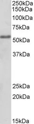Anti-FOXC1 antibody, Internal used in Western Blot (WB). GTX89469