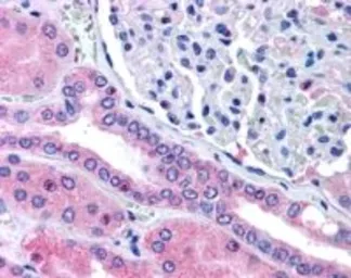Anti-Rhophilin 2 antibody, Internal used in IHC (Paraffin sections) (IHC-P). GTX89485