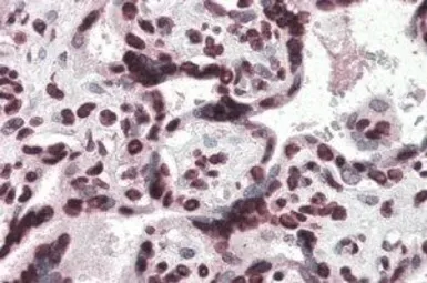 Anti-HMGA1 antibody, Internal used in IHC (Paraffin sections) (IHC-P). GTX89486