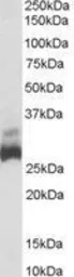 Anti-SDHB antibody, C-term used in Western Blot (WB). GTX89491