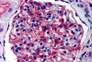 Anti-Aminopeptidase A antibody, Internal used in IHC (Paraffin sections) (IHC-P). GTX89515