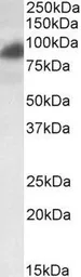Anti-RAB11FIP1 antibody, Internal used in Western Blot (WB). GTX89523