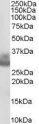 Anti-Cathepsin F antibody, C-term used in Western Blot (WB). GTX89526