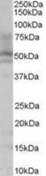 Anti-HNF4 alpha antibody, N-term used in Western Blot (WB). GTX89532