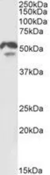 Anti-HNF4 alpha antibody, N-term used in Western Blot (WB). GTX89532