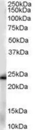 Anti-GSTP1 antibody, Internal used in Western Blot (WB). GTX89536