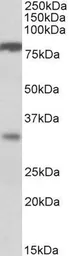 Anti-CLCA1 antibody, Internal used in Western Blot (WB). GTX89537