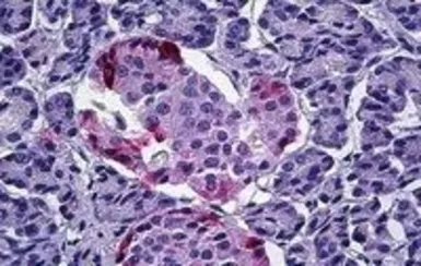 Anti-Pancreatic Polypeptide antibody, Internal used in IHC (Paraffin sections) (IHC-P). GTX89539