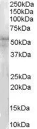 Anti-IRAK4 antibody, N-term used in Western Blot (WB). GTX89550