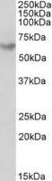 Anti-GAD65 antibody, Internal used in Western Blot (WB). GTX89575