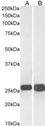 Anti-SNAP25 antibody, C-term used in Western Blot (WB). GTX89577