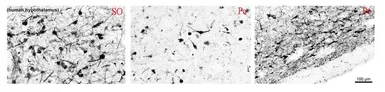Anti-Tyrosine Hydroxylase antibody, C-term used in IHC (Frozen sections) (IHC-Fr). GTX89578