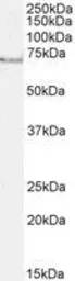 Anti-AChE antibody, C-term used in Western Blot (WB). GTX89580