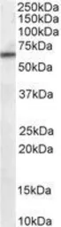 Anti-PPP2R1A antibody, C-term used in Western Blot (WB). GTX89587