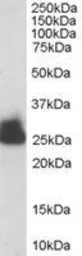 Anti-Triosephosphate isomerase antibody, C-term used in Western Blot (WB). GTX89594
