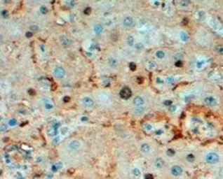 Anti-Triosephosphate isomerase antibody, C-term used in IHC (Paraffin sections) (IHC-P). GTX89594